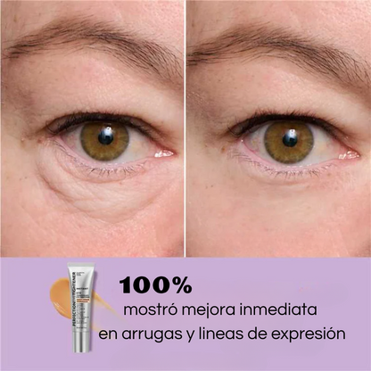 Instant Lift - Arrugas & Ojeras (Efecto Tensor)